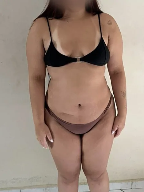 Aluna antes do Método ShapeFit