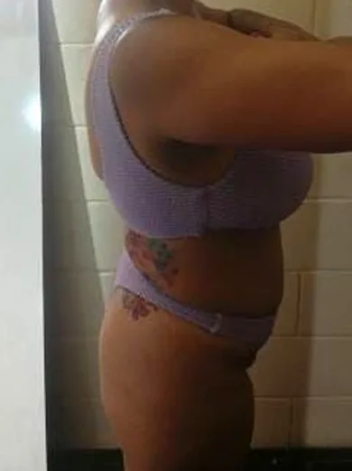 A mesma aluna depois do Método ShapeFit